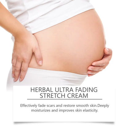 Pregnancy stretch marks cream Silcy Skin, herbal ultra fading formula on cradled belly on Tampa Home & Garden Store