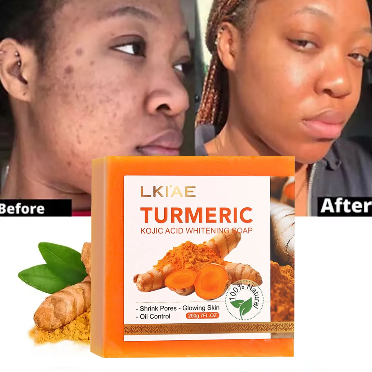 LKIAE Turmeric Kojic Acid Whitening Soap 200g box with turmeric imagery by Silcy Skin on Tampa Home & Garden Store