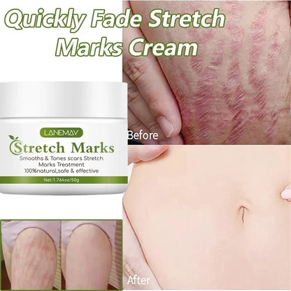 Stretch Marks Cream jar by Lanemav white container with green label maternity skin care collage on Tampa Home & Garden Store