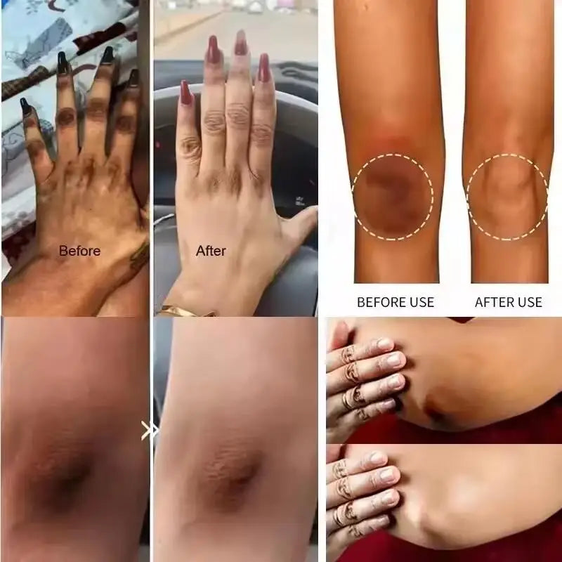 Whitening Cream Silcy Skin before after on hands underarms inner thighs on Tampa Store on Tampa Home & Garden Store