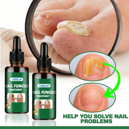 VIBEUP Nail Fungus Treatment serum bottles with labels and droppers, shows nail healing on Tampa Home & Garden Store