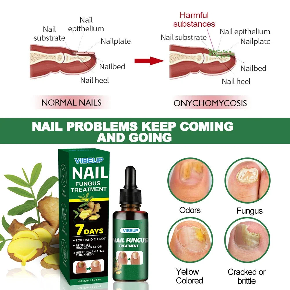 VibeUp Nail Fungus Treatment box and dropper bottle with green packaging and plant imagery on Tampa Home & Garden Store