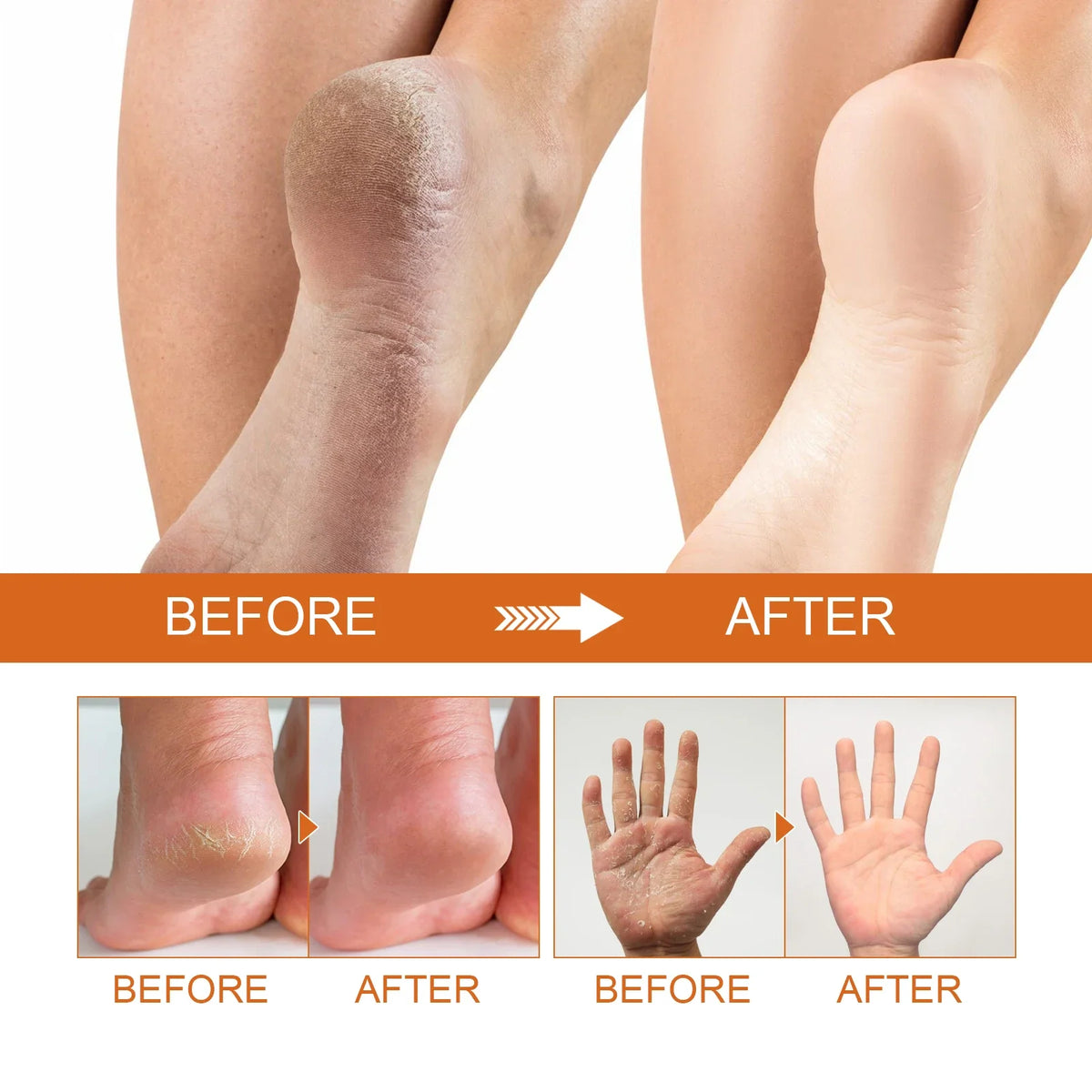 Foot exfoliating spray by Silcy Skin for dead skin removal and foot moisturization on Tampa Home & Garden Store