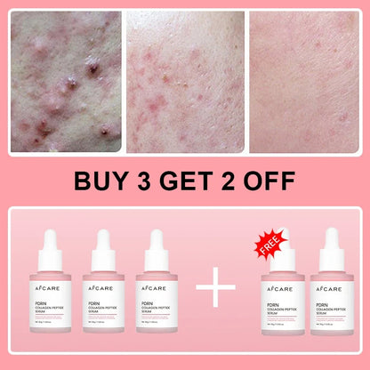 Silcy Skin AFCARE PDRN collagen peptide serum bottles, pink dropper, 5-pack promo on Tampa Home & Garden Store