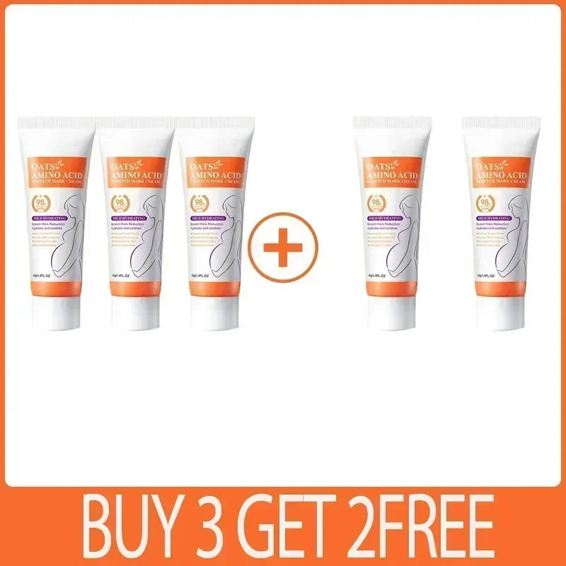 Silcy Skin pregnancy stretch mark cream tubes orange and white packaging set of 5 on Tampa Home & Garden Store