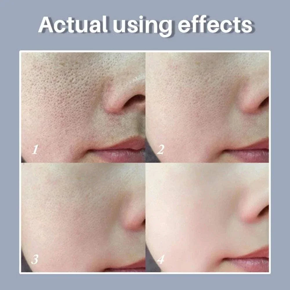 Silcy Skin Texture pore-refining serum collage of four cheek close-ups showing pore reduction on Tampa Home & Garden Store