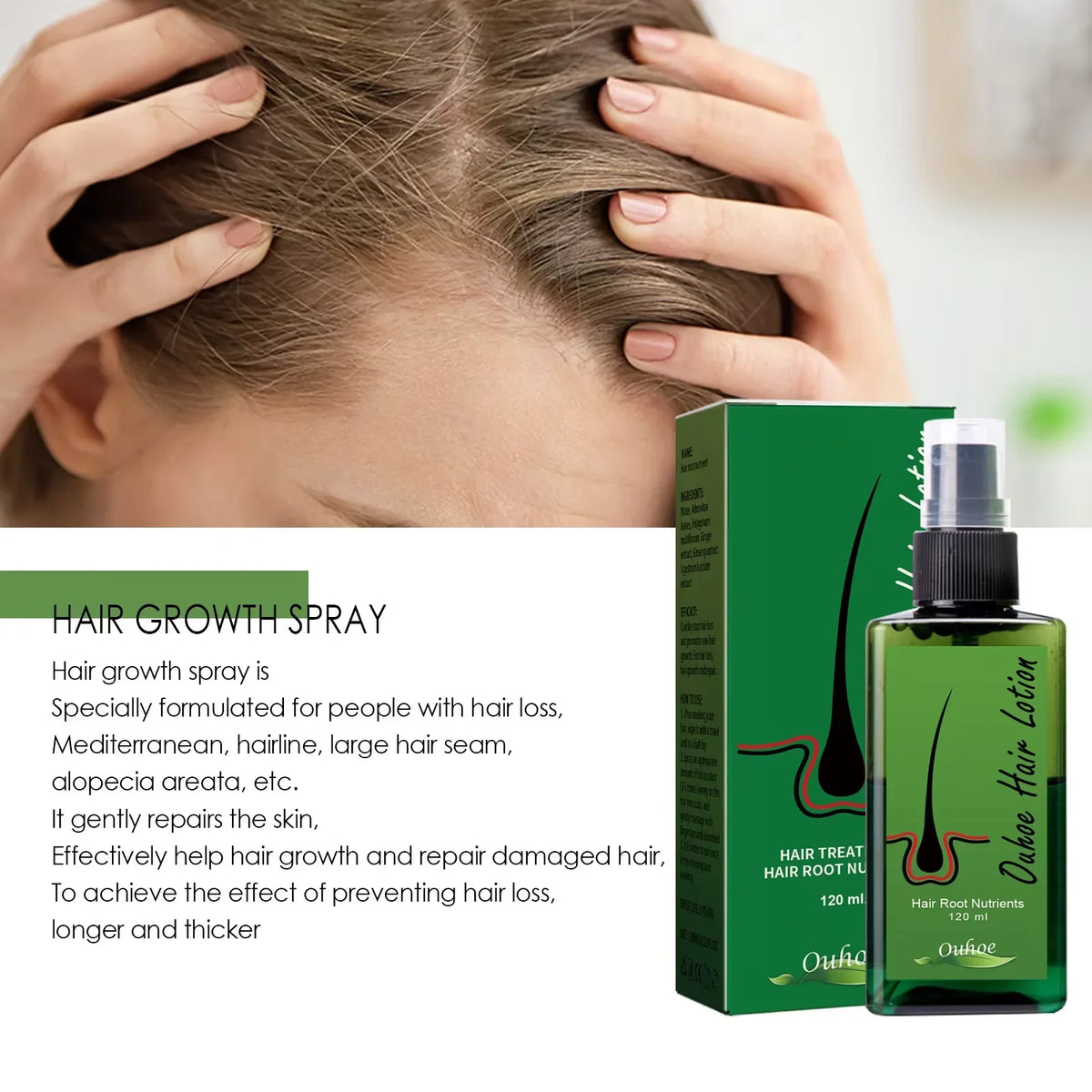 Hair Growth Spray by Silcy Skin, green bottle with pump and green box for scalp repair on Tampa Home & Garden Store