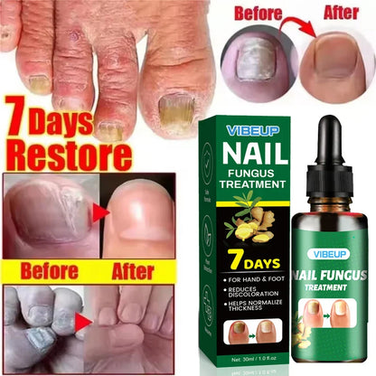 7 Days Fungal Nail Treatment serum by Silcy Skin bottle and box set (2-pc) nail fungus care on Tampa Home & Garden Store
