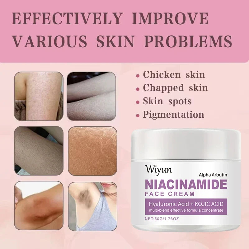 Niacinamide Face Cream jar by Wiyun with Hyaluronic Acid + Kojic Acid; skin issue collage on Tampa Home & Garden Store