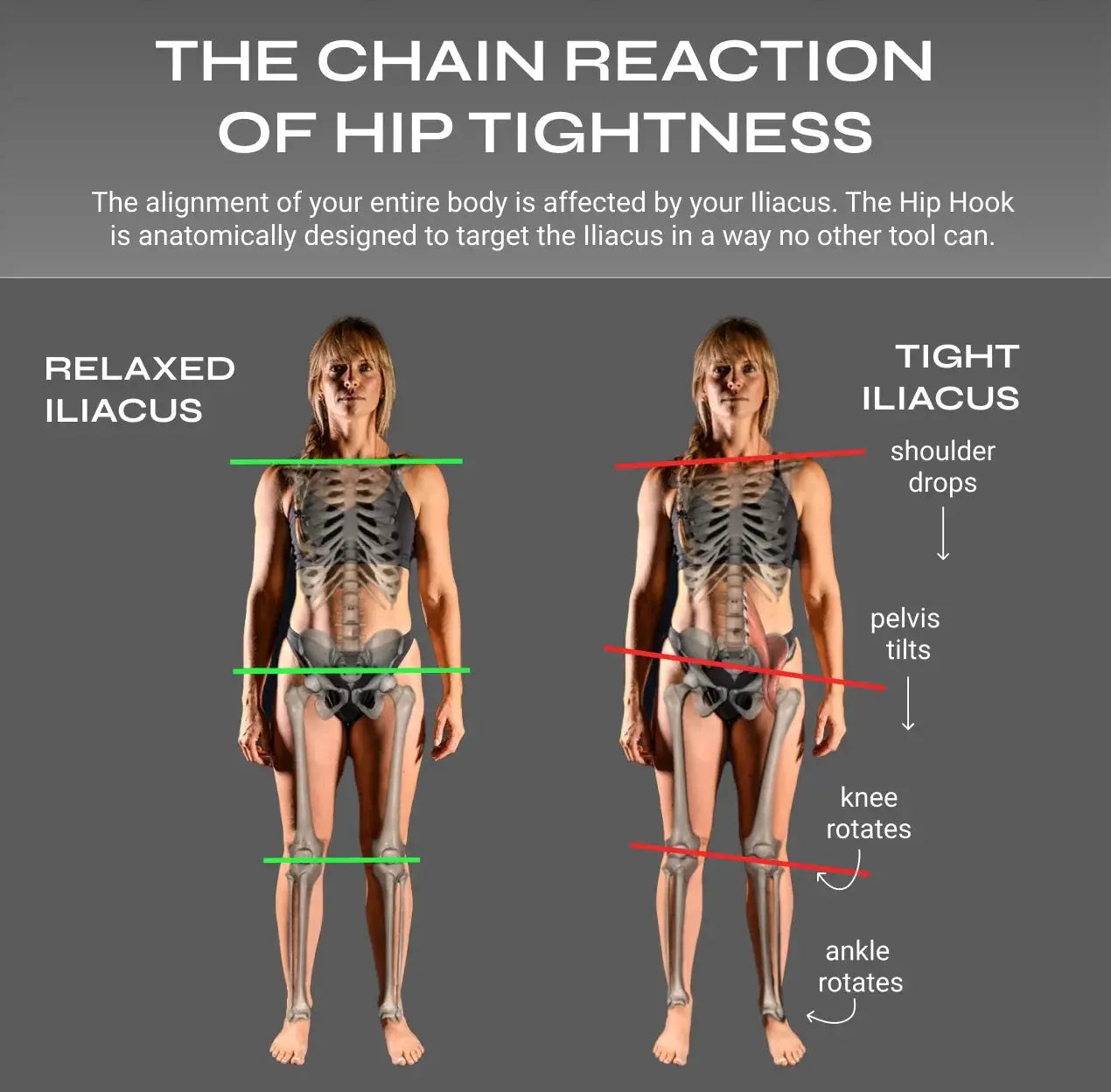 Full Body System Aletha Health — silhouettes relaxed vs tight iliacus, green-red lines on Tampa Home & Garden Store