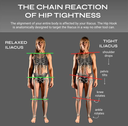 Full Body System Aletha Health — silhouettes relaxed vs tight iliacus, green-red lines on Tampa Home & Garden Store