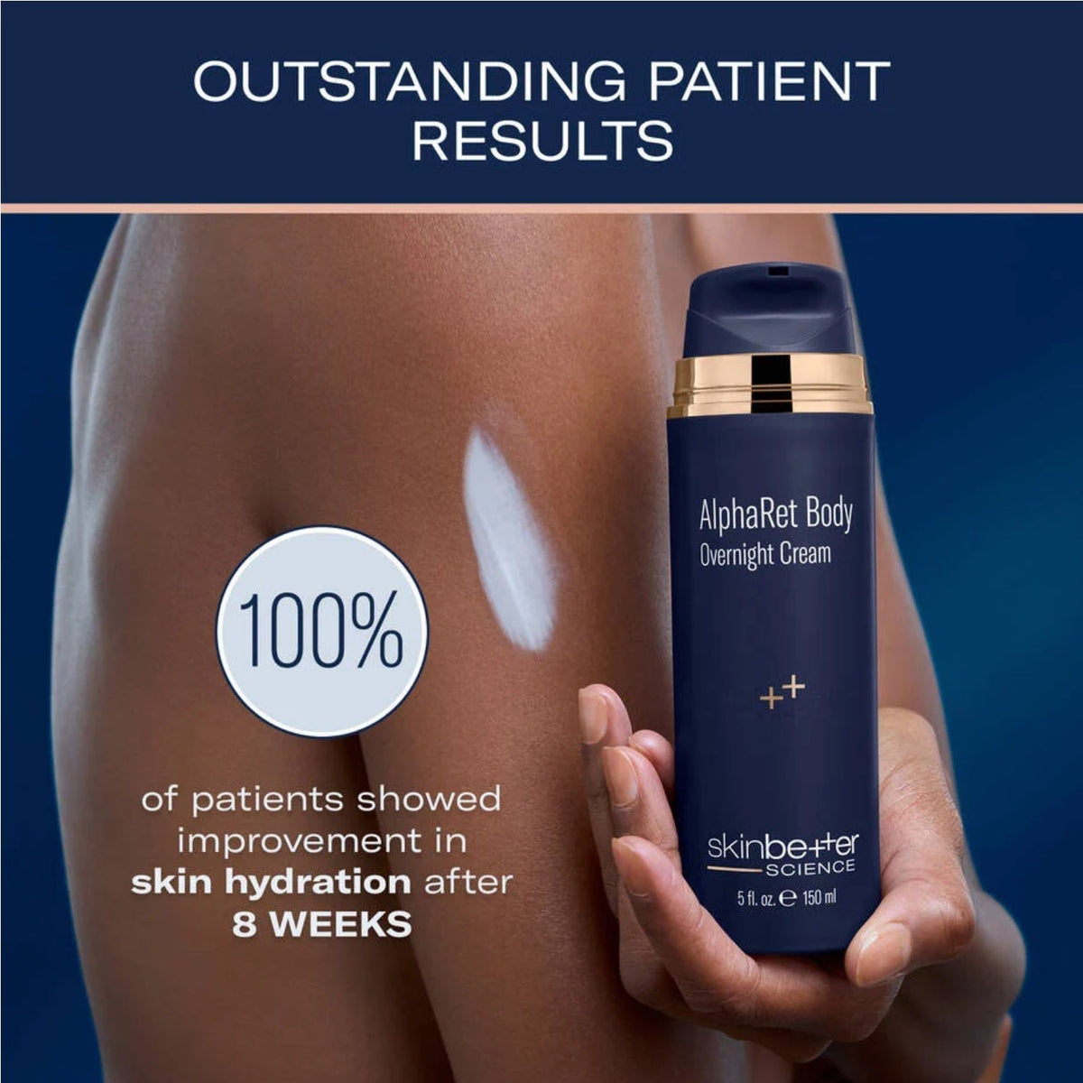 Skinbetter AlphaRet Body Overnight Cream bottle, navy blue with gold pump, by Nava Beauty on Tampa Home & Garden Store