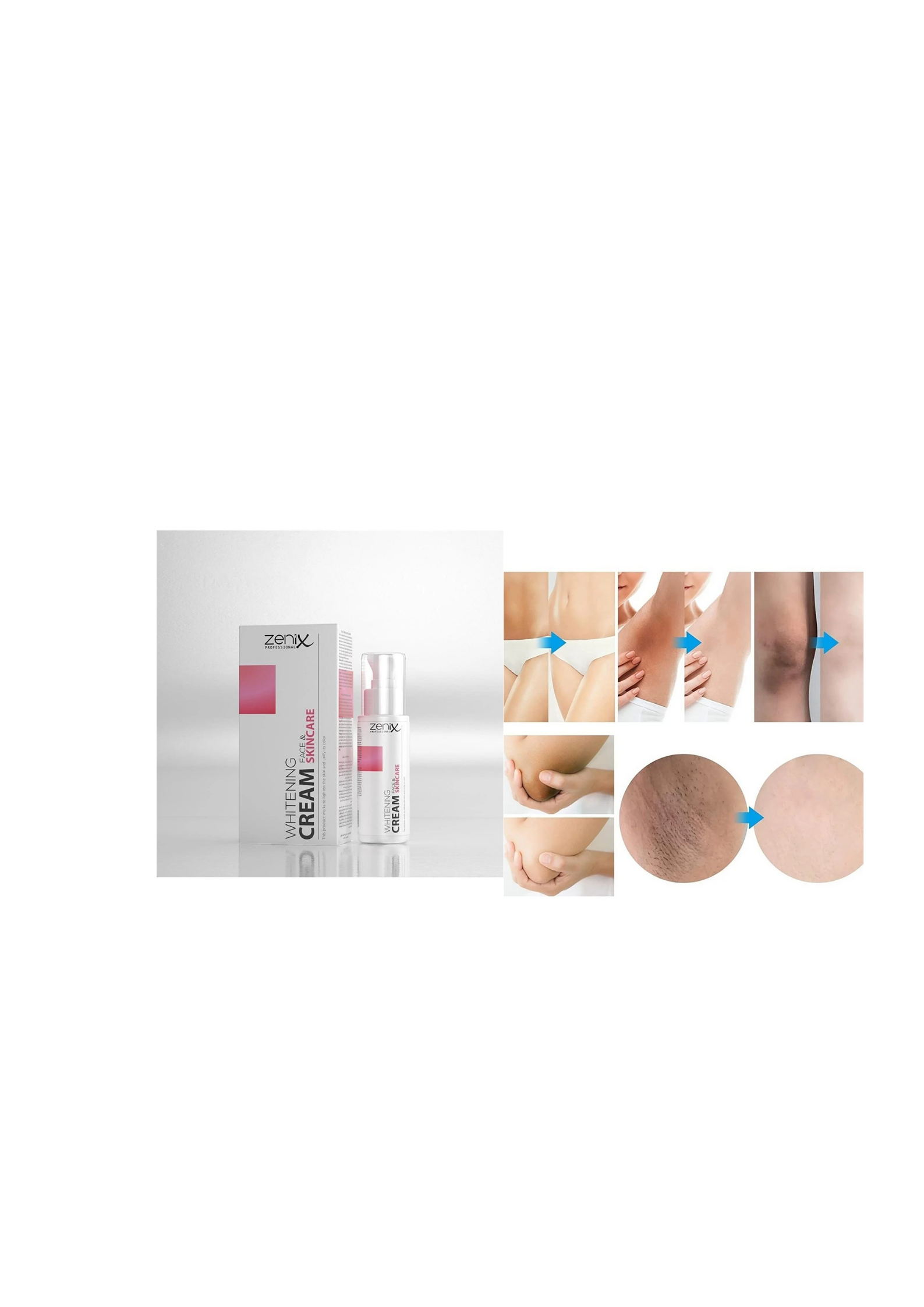 Zenix Whitening Cream 75 ml 5-pack by Beauty Care Bag; skin care for private areas and underarms on Tampa Home & Garden Store