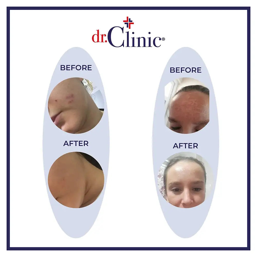 drClinic Vitamin C facial serum logo with two-panel before/after skin improvement collage on Tampa Home & Garden Store