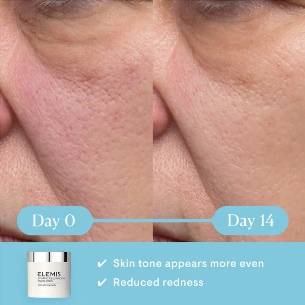 Elemis Dynamic Resurfacing Facial Pads 60 Pack
