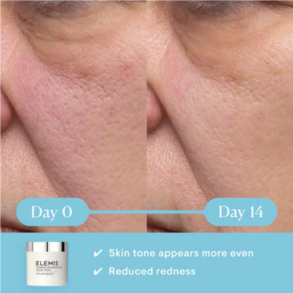 Elemis Dynamic Resurfacing Facial Pads 60 Pack