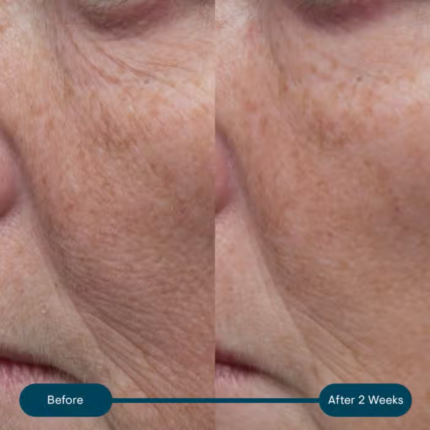 Elemis Pro-Collagen SPF 30 50 ml cream shows smoother skin after 2 weeks Nava Beauty on Tampa Home & Garden Store