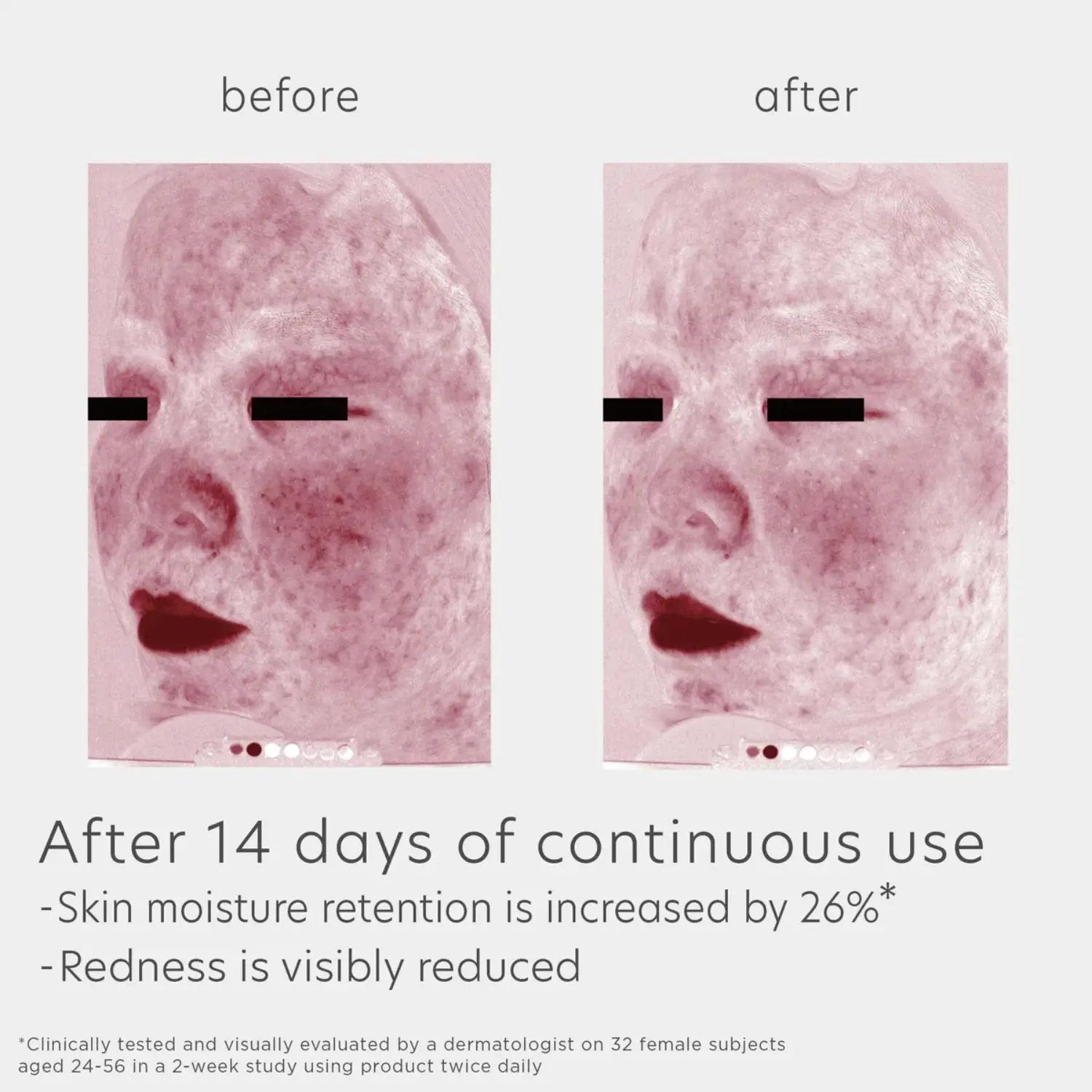 EltaMD Skin Recovery Amino Acid Foaming Cleanser before and after skin shows reduced redness on Tampa Home & Garden Store