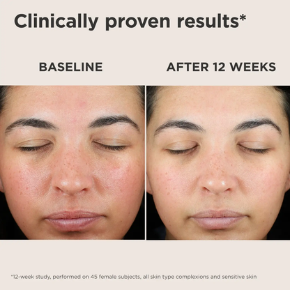 Before and after close-up of a woman's face showing improved skin tone with EltaMD UV Skin Recovery Green Tint SPF 50 by Nava Beauty on Tampa Home & Garden Store