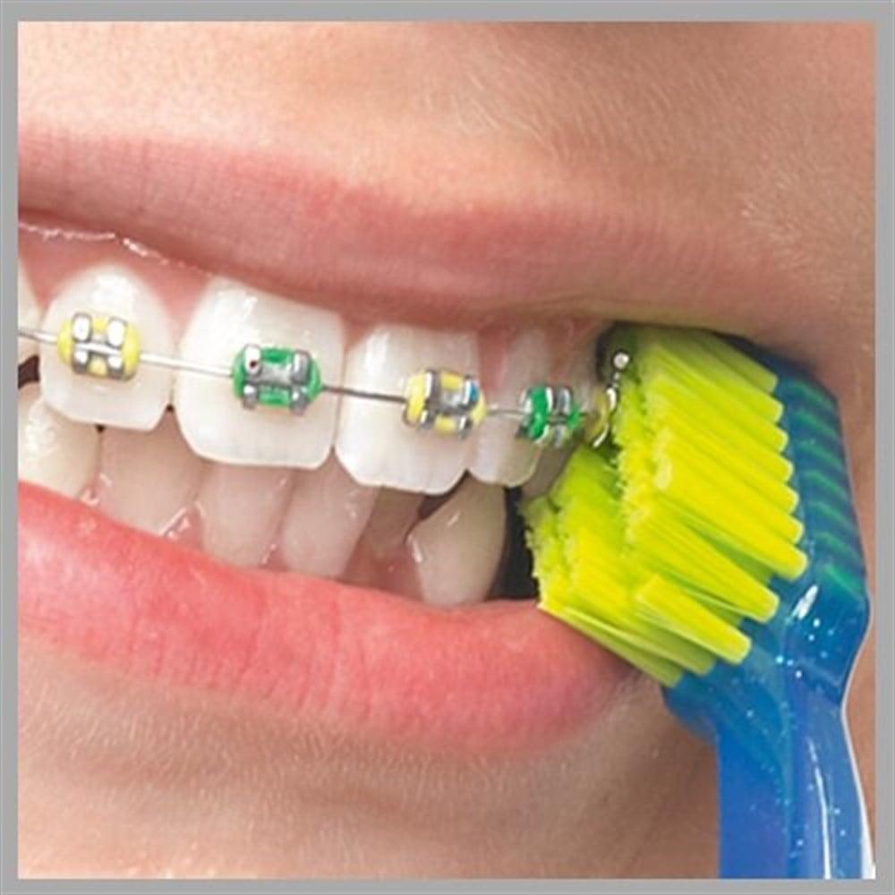 Orthodontic toothbrush Curaprox CS 5460 for braces, yellow bristles, blue handle on Tampa Home & Garden Store