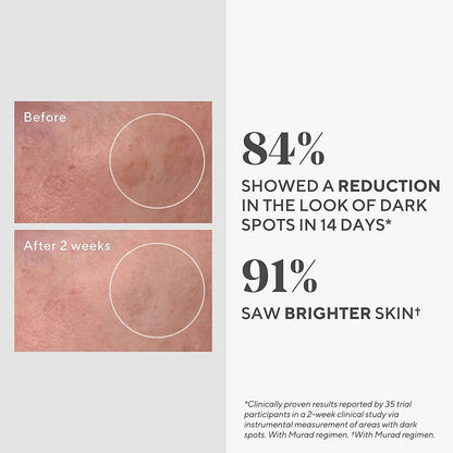 DR.Murad Dark Spot Correcting Serum before vs after 2 wks, 84% reduction, 91% brighter skin on Tampa Home & Garden Store