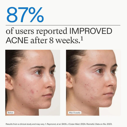 Nutrafol Clear Skin nutraceutical acne supplement by Nava Beauty 3-month supply before/after acne on Tampa Home & Garden Store