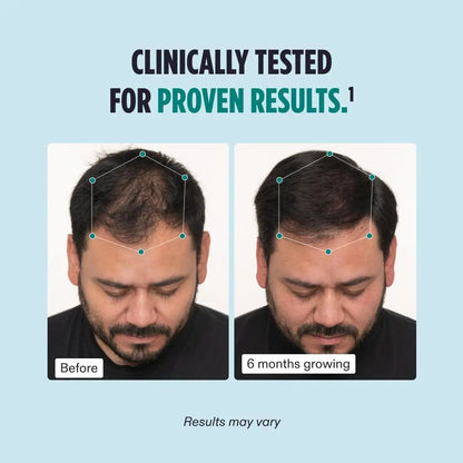 Nutrafol Men's Hair Growth Supplement Nava Beauty 2-panel before/after 6 months growing on Tampa Home & Garden Store