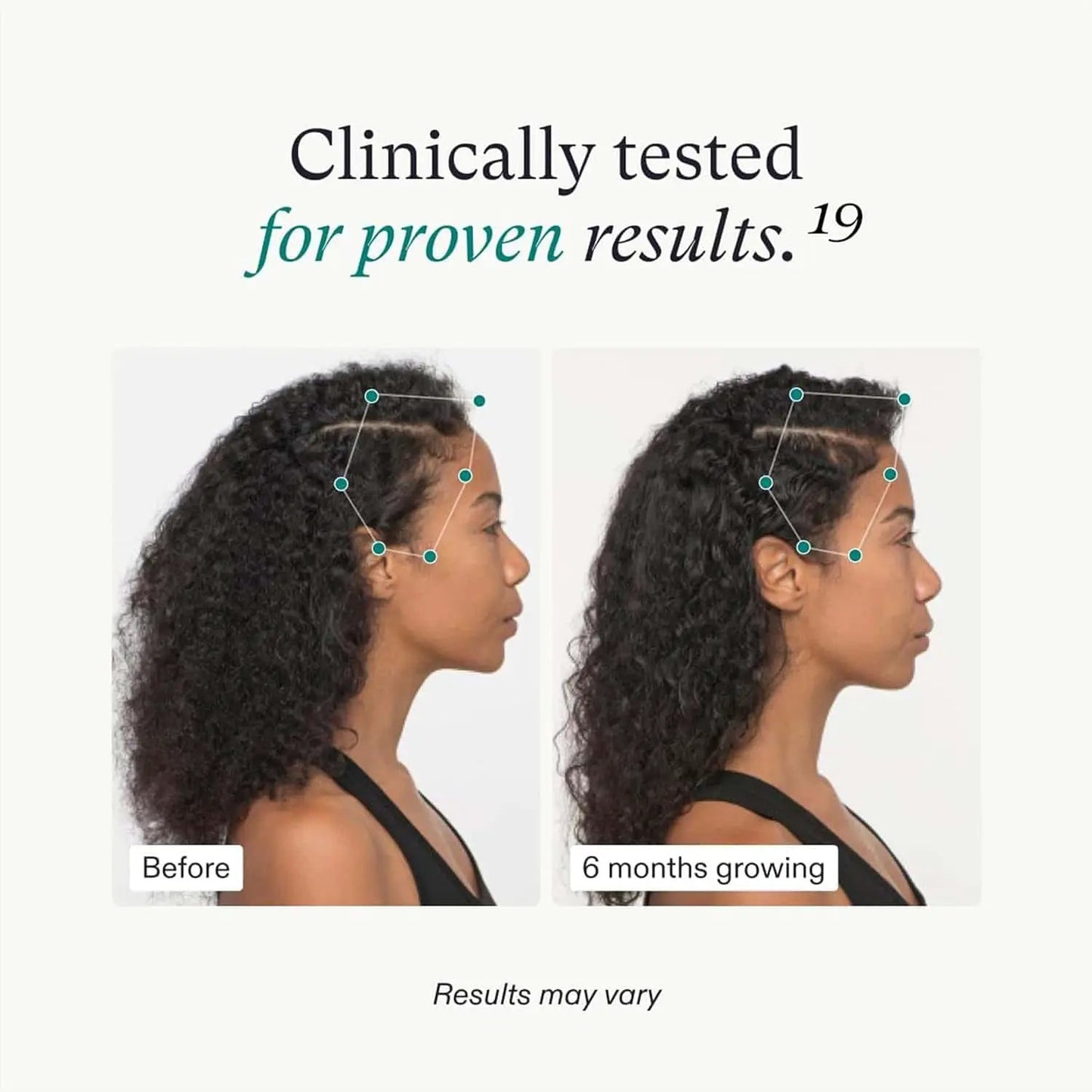 Nutrafol Women's Vegan Hair Growth Supplement Pack 3-Month Supply before/after hair growth on Tampa Home & Garden Store