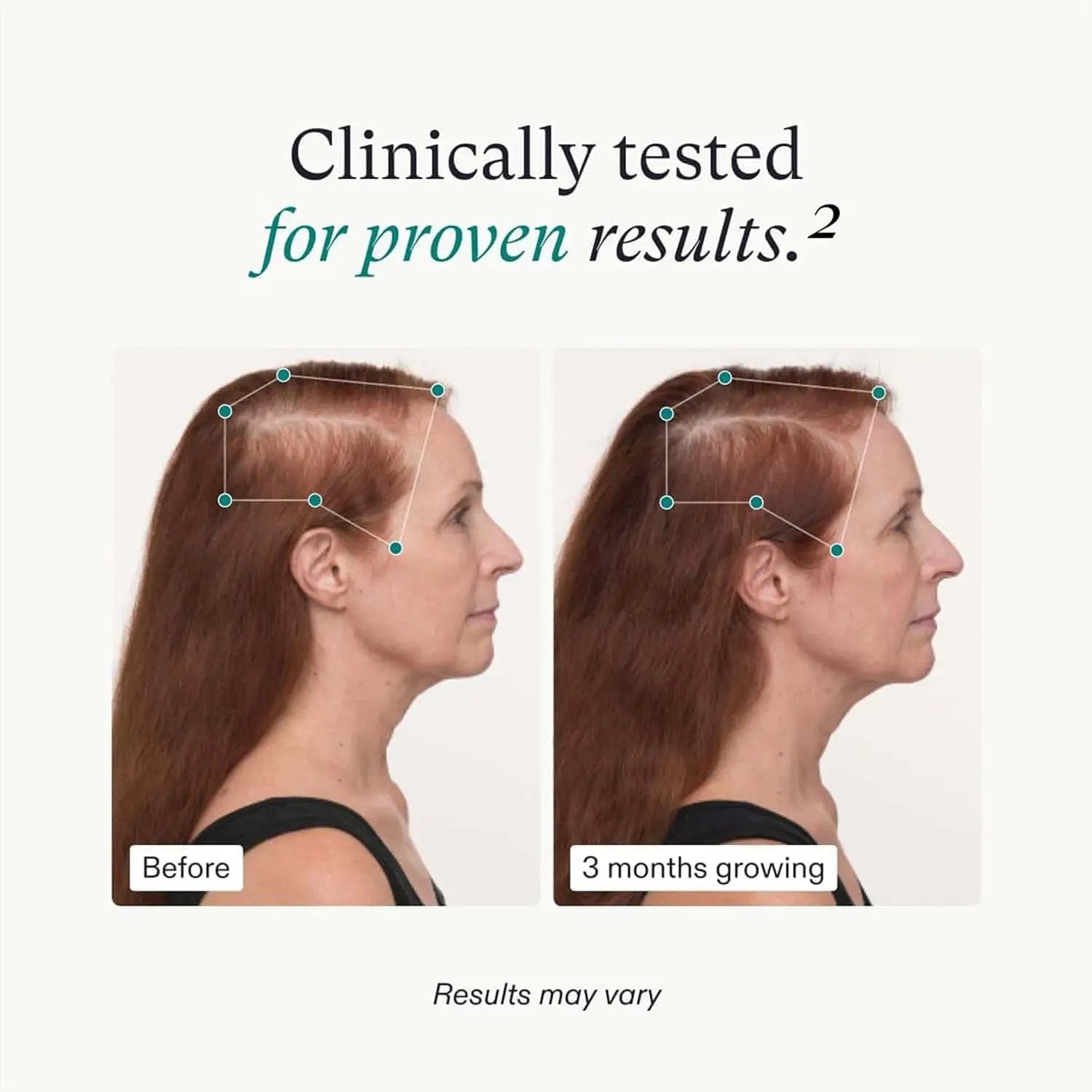 Nutrafol Women's Balance Hair Growth Pack 3mo Supply Nava Beauty before and after scalp on Tampa Home & Garden Store